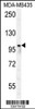 Western blot analysis in MDA-MB435 cell line lysates (35ug/lane) .