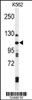 Western blot analysis of TELO2 Antibody in K562 cell line lysates (35ug/lane)