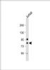 Western Blot at 1:1000 dilution + Jurkat whole cell lysate Lysates/proteins at 20 ug per lane.