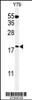 Western blot analysis of TXNDC12 Antibody in Y79 cell line lysates (35ug/lane)