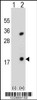 Western blot analysis of PLA2G1B using rabbit polyclonal PLA2G1B Antibody using 293 cell lysates (2 ug/lane) either nontransfected (Lane 1) or transiently transfected (Lane 2) with the PLA2G1B gene.