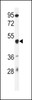 Western blot analysis of GSDMA Antibody in mouse liver tissue lysates (35ug/lane)