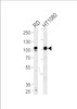 Western blot analysis of lysates from RD, HT1080 cell line (from left to right) , using ATP2A1 Antibody .AP4905b was diluted at 1:1000 at each lane.