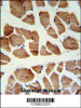 ATP2A1 Antibody IHC analysis in formalin fixed and paraffin embedded human skeletal muscle followed by peroxidase conjugation of the secondary antibody and DAB staining.