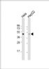 Western Blot at 1:1000 dilution Lane 1: Hela whole cell lysate Lane 2: HepG2 whole cell lysate Lysates/proteins at 20 ug per lane.