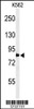 Western blot analysis of PLA2G4B Antibody in K562 cell line lysates (35ug/lane)