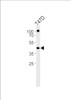 Western blot analysis of lysate from T47D cell line, using RXRA Antibody at 1:1000.