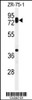 Western blot analysis of HAS1 Antibody in ZR-75-1 cell line lysates (35ug/lane)