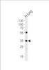 Western blot analysis of lysate from human lung tissue lysate, using MFAP4 Antibody at 1:1000 at each lane.