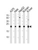 Western blot analysis of lysates from A375, Hela, HepG2 cell line, mouse brain and rat liver tissue lysate (from left to right) , using ITPA Antibody at 1:1000 at each lane.