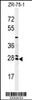 Western blot analysis of NAT8 Antibody in ZR-75-1 cell line lysates (35ug/lane)