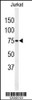 Western blot analysis of PAN3 Antibody in Jurkat cell line lysates (35ug/lane)