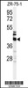 Western blot analysis of KRT35 Antibody in ZR-75-1 cell line lysates (35ug/lane)