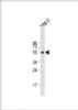 Western Blot at 1:2000 dilution + 786-0 whole cell lysate Lysates/proteins at 20 ug per lane.