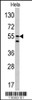 Western blot analysis of CA9 antibody in Hela cell line lysates (35ug/lane)