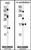 (LEFT) Western blot analysis of TPPP3 Antibody in WiDr cell tissue lysates (35ug/lane) .TPPP3 (arrow) was detected using the purified Pab. (RIGHT) Western blot analysis of TPPP3 Antibody in mouse cerebellum tissue lysates (35ug/lane) .TPPP3 (arrow) was detected using the purified Pab.