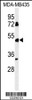 Western blot analysis of BTNL8 Antibody in MDA-MB435 cell line lysates (35ug/lane)