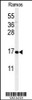 Western blot analysis of CMTM7 Antibody in Ramos cell line lysates (35ug/lane)