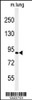 Western blot analysis of H6PD Antibody in mouse lung tissue lysates (35ug/lane)