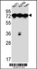 Western blot analysis in A375, A2058, Hela cell line lysates (35ug/lane) .