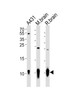 Western blot analysis of lysates from A431 cell line, mouse brain, rat brain tissue (from left to right) , using S100B Antibody at 1:1000 at each lane.