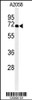 Western blot analysis of XRCC6 Antibody in A2058 cell line lysates (35ug/lane)