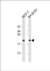 Western Blot at 1:2000 dilution Lane 1: MCF-7 whole cell lysate Lane 2: SH-SY5Y whole cell lysate Lysates/proteins at 20 ug per lane.