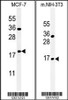 (LEFT) Western blot analysis of BTG1 Antibody in MCF-7 cell line lysates (35ug/lane) .BTG1 (arrow) was detected using the purified Pab. (RIGHT) Western blot analysis of BTG1 Antibody in mouse NIH-3T3 tissue lysates (35ug/lane) .BTG1 (arrow) was detected using the purified Pab.
