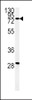 Western blot analysis of ZFYVE16 Antibody in K562 cell line lysates (35ug/lane)