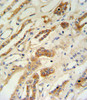 ZFYVE16 Antibody IHC analysis in formalin fixed and paraffin embedded lung tissue followed by peroxidase conjugation of the secondary antibody and DAB staining.