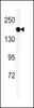 Western blot analysis of DGKK Antibody in mouse lung tissue lysates (35ug/lane)