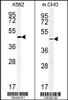 (LEFT) Western blot analysis of ENTPD8 Antibody in K562 cell line lysates (35ug/lane) .ENTPD8 (arrow) was detected using the purified Pab. (RIGHT) Western blot analysis of ENTPD8 Antibody in CHO cell line lysates (35ug/lane) .ENTPD8 (arrow) was detected using the purified Pab.