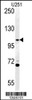 Western blot analysis of ACAP3 Antibody in U251 cell line lysates (35ug/lane)