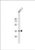 Western Blot at 1:2000 dilution + MCF-7 whole cell lysate Lysates/proteins at 20 ug per lane.