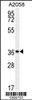 Western blot analysis of MFSD3 Antibody in A2058 cell line lysates (35ug/lane)