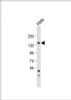 Western Blot at 1:1000 dilution + Hela whole cell lysate Lysates/proteins at 20 ug per lane.