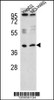 Western blot analysis of RSAD1 Antibody in HepG2, NCI-H460 cell line lysates (35ug/lane)