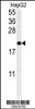 Western blot analysis in HepG2 cell line lysates (35ug/lane) .  This demonstrates the SFT2D3 antibody detected the SFT2D3 protein (arrow) .