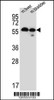 Western blot analysis of TMEM87B Antibody in mouse liver, bladder tissue lysates (35ug/lane)