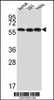 Western blot analysis of UTP6 Antibody in Jurkat, 293, Hela cell line lysates (35ug/lane)