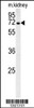 Western blot analysis in mouse kidney tissue lysates (35ug/lane) .This demonstrates the detected GNE protein (arrow) .