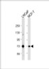 Western Blot at 1:1000 dilution Lane 1: LNCaP whole cell lysate Lane 2: MCF-7 whole cell lysate Lysates/proteins at 20 ug per lane.