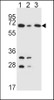 Western blot analysis in K562 (lane 1) , HepG2 (lane 2) , Jurkat (lane 3) cell line lysates (35ug/lane) .