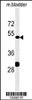 Western blot analysis in mouse bladder tissue lysates (35ug/lane) .