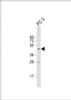 Western Blot at 1:1000 dilution + PC-3 whole cell lysate Lysates/proteins at 20 ug per lane.