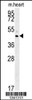 Western blot analysis in mouse heart tissue lysates (35ug/lane) .This demonstrates the detected C3orf31 protein (arrow) .