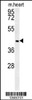 Western blot analysis in mouse heart tissue lysates (35ug/lane) .This demonstrates the detected NIPAL2 protein (arrow) .