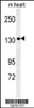 Western blot analysis in mouse heart tissue lysates (35ug/lane) .This demonstrates the ANKRD32 antibody detected ANKRD32 protein (arrow) .