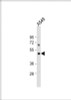 Western Blot at 1:1000 dilution + A549 whole cell lysate Lysates/proteins at 20 ug per lane.