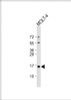 Western Blot at 1:1000 dilution + MOLT-4 whole cell lysate Lysates/proteins at 20 ug per lane.